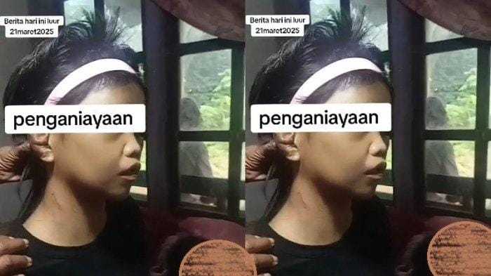 ART di Banyumas Diduga Dianiaya Majikan, Keluarga Dimintai Tebusan Rp5 Juta