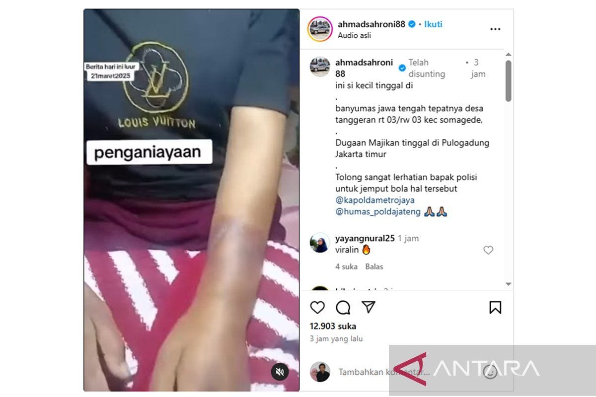 Polisi Selidiki Video Viral Dugaan Penganiayaan ART Asal Banyumas