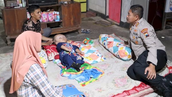 Polres Grobogan Bantu Anak Penderita Hidrosefalus Jelang HUT ke-79 Bhayangkara