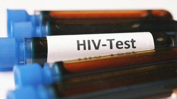 Miris, Balita dan 14 Remaja di Cilacap Terinfeksi HIV/AIDS
