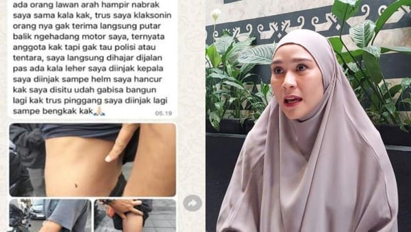 Polisi Ungkap Pelaku Pemukulan Staf Artis Zaskia, Anggota TNI
